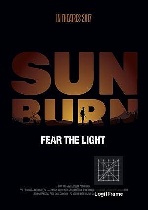 Sunburn 